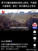男子扫墓后胸痛气道现菌斑 医生紧急提醒