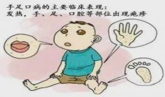 手足口病预防知识——鹤山市沙坪街道汇源小学