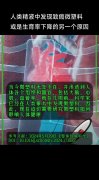 精液研究新发现：微塑料现身于人类精液，警示潜在致癌风险